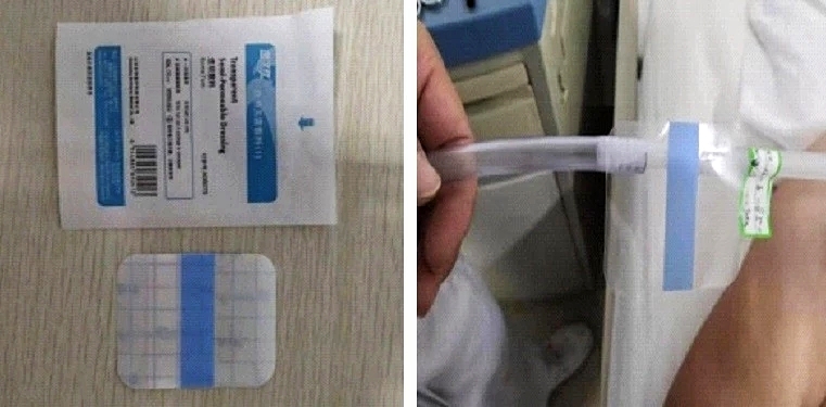 有效防止引流管滑脱的小窍门