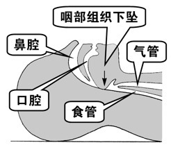 图 11.png