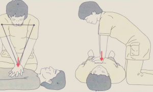 【急救】心肺复苏操作步骤