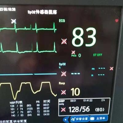 关于心电监护，这些你可能不懂