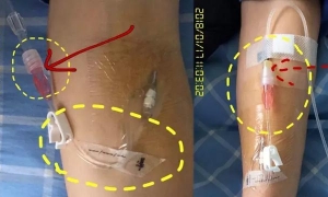 留置针肝素帽取下后，还能继续使用吗？