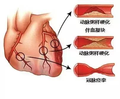 史上最全的心血管疾病图文详解 记得收藏