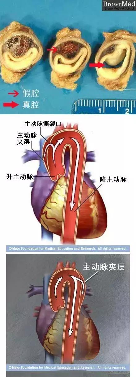 史上最全的心血管疾病图文详解 记得收藏