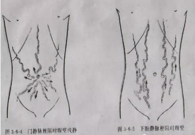 腹部体格检查