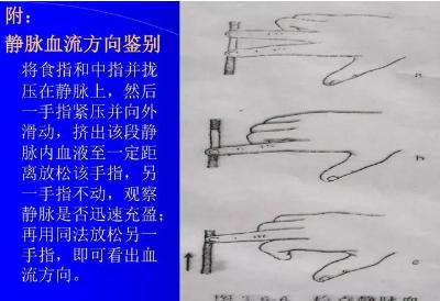 腹部体格检查