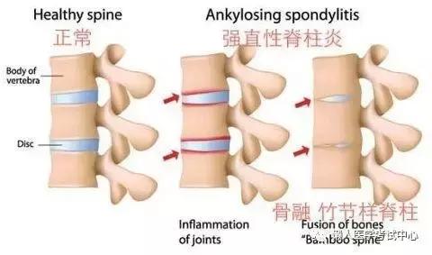 运动系统——10分钟搞定