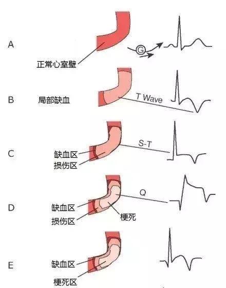 心血管系统——10分钟搞定！