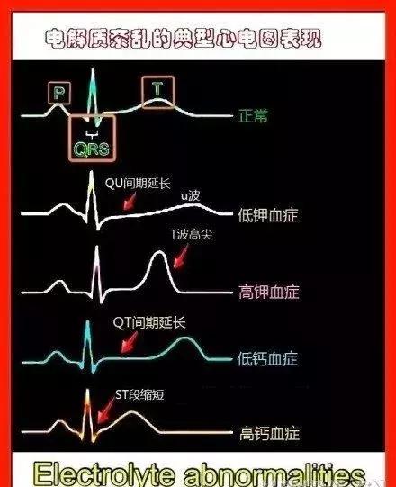 心血管系统——10分钟搞定！