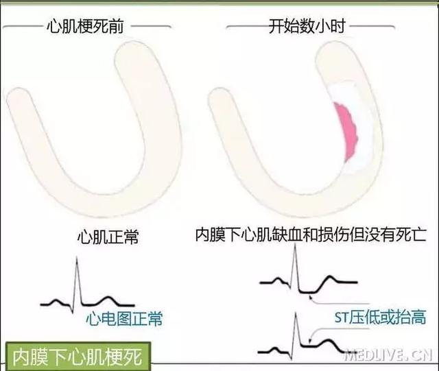 心血管系统——10分钟搞定！