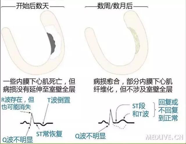 心血管系统——10分钟搞定！