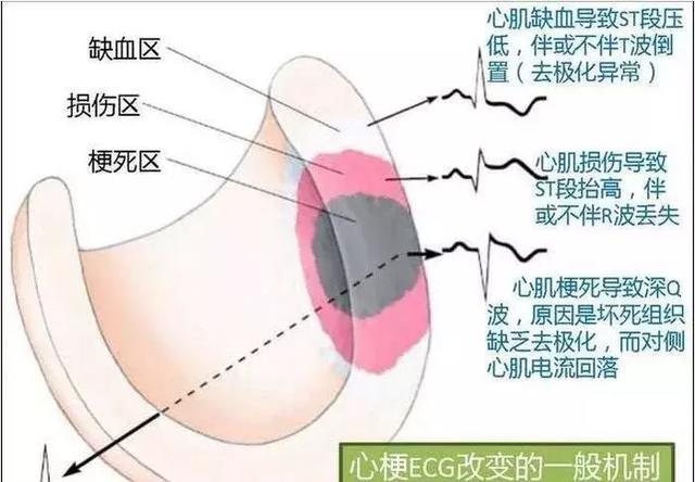 心血管系统——10分钟搞定！