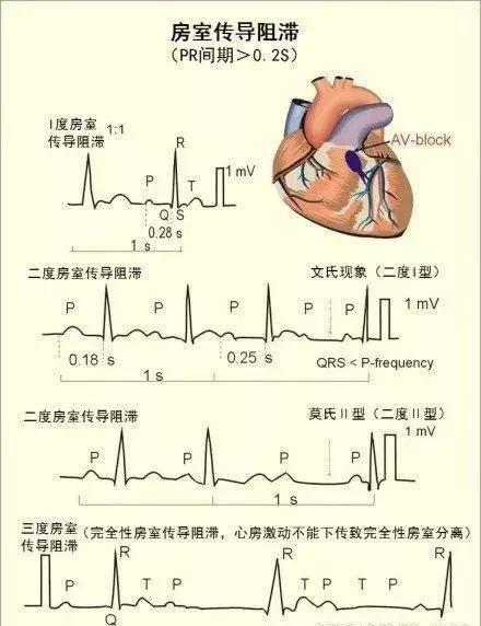 心血管系统——10分钟搞定！