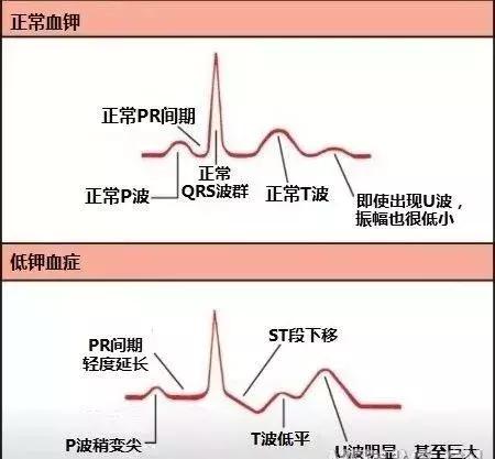 心血管系统——10分钟搞定！