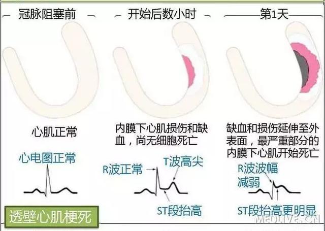 心血管系统——10分钟搞定！