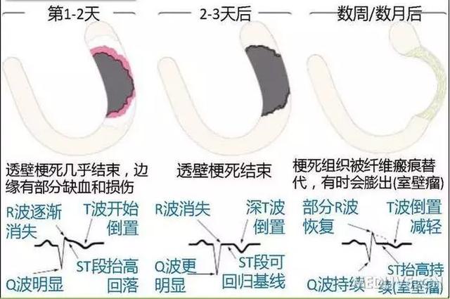 心血管系统——10分钟搞定！