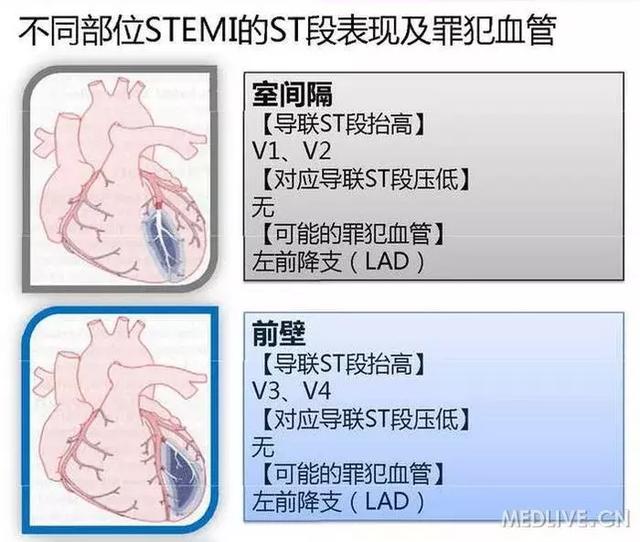 心血管系统——10分钟搞定！