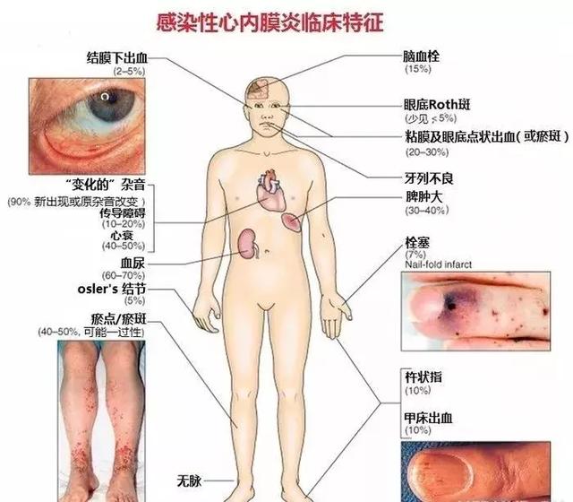 心血管系统——10分钟搞定！